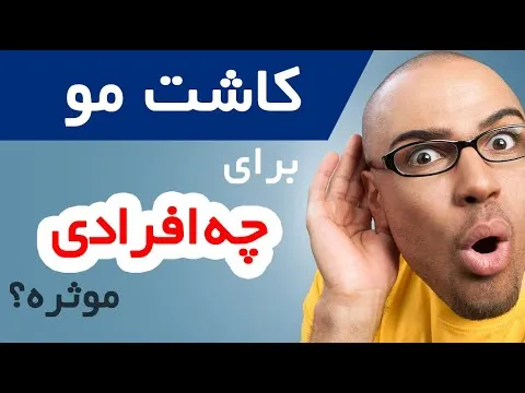 کاشت مو تهران