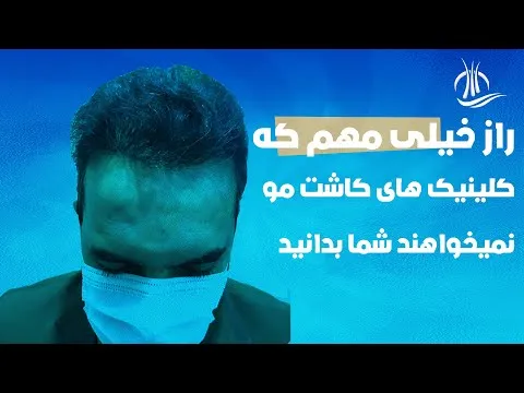 کاشت مو