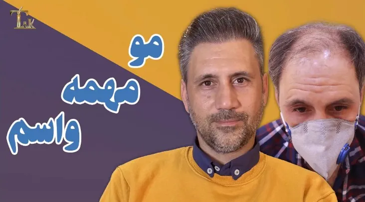 کاشت مو تهران